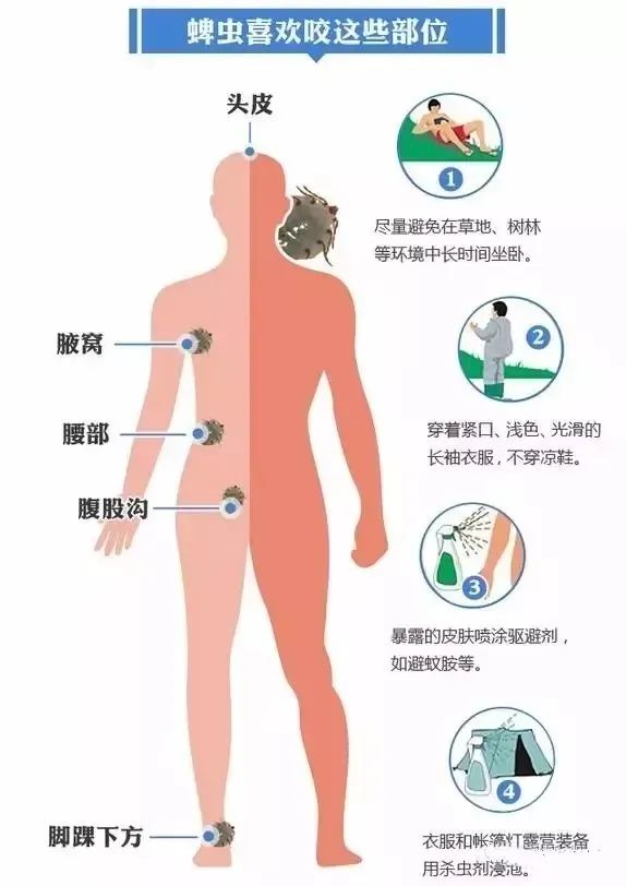 广东省蜱感染，深入了解与应对